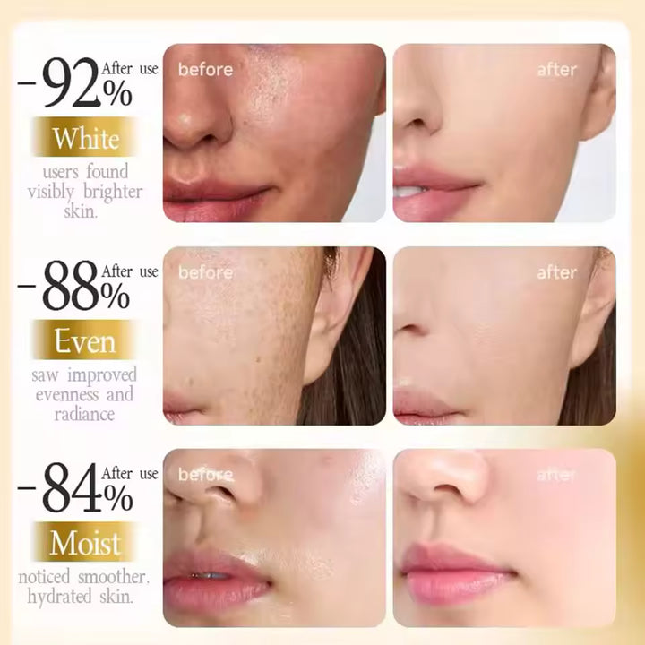 ✨ LAST DAY BUY 1 GET 1 FREE✨PDRN: Visibly Firmer, Lifted Skin in 72 Hours — No Needles, No Clinic Visits