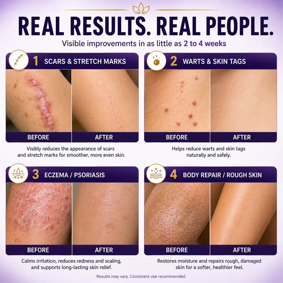 Limited-time offer: 70% off ⬇️Elivessa™ Biotin 10-in-1 Skin Restoration Cream