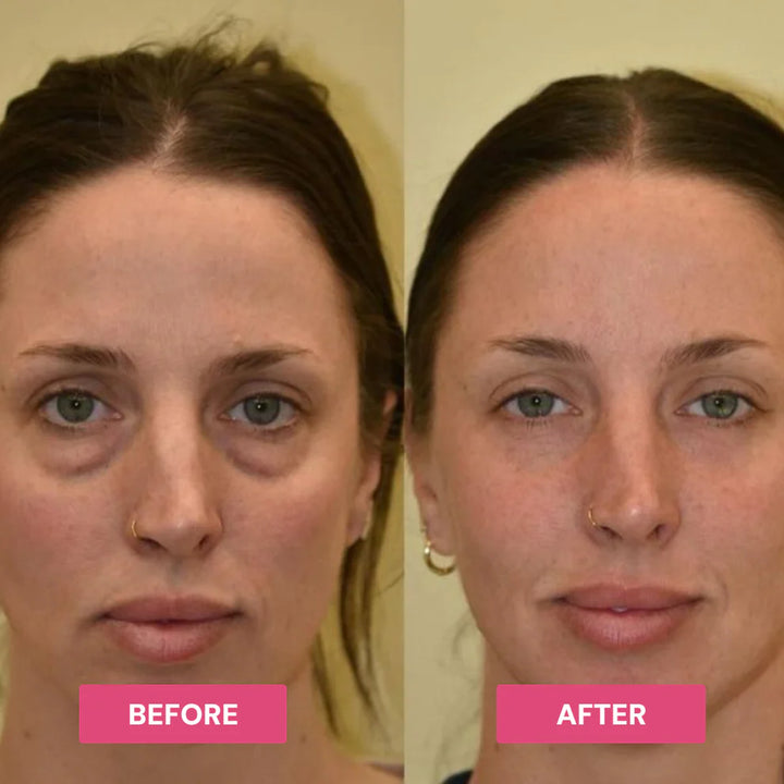 Revive Tired Eyes – Hydrating &amp; Anti-Wrinkle Eye Balm