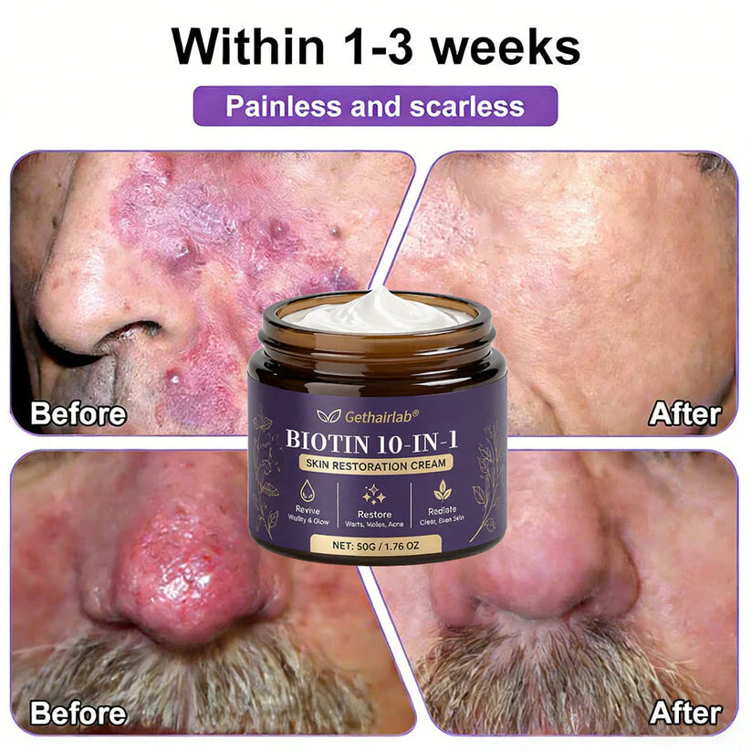 Made and Shipped from USA ✨Gethairlab® Biotin 10-in-1 Skin Restoration Cream 🍀