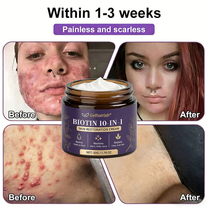 Made and Shipped from USA ✨Gethairlab® Biotin 10-in-1 Skin Restoration Cream 🍀