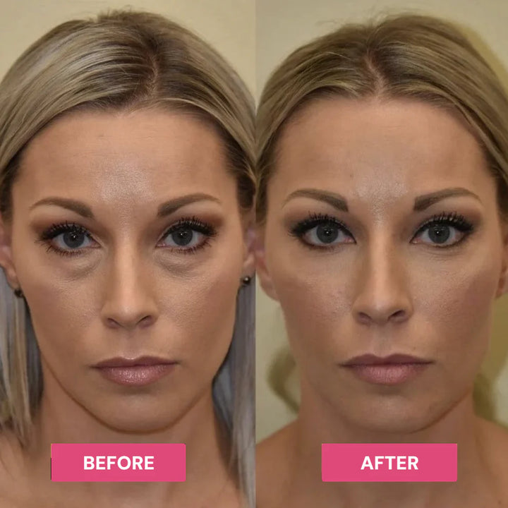Revive Tired Eyes – Hydrating &amp; Anti-Wrinkle Eye Balm