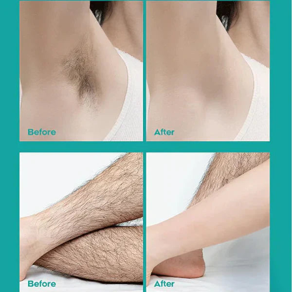 ❤️Limited Sale 50% OFF🔥Painless Full Body Hair Removal Cream for Men &amp; Women– Skin-friendly for all areas🌿