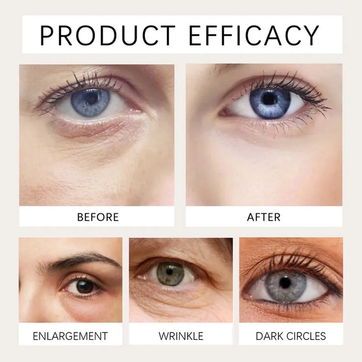 Elycura™ The Instant Eye Lift That Doesn&