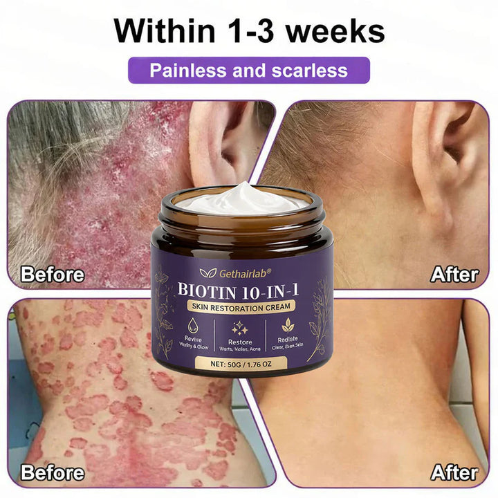 Made and Shipped from USA ✨Gethairlab® Biotin 10-in-1 Skin Restoration Cream 🍀