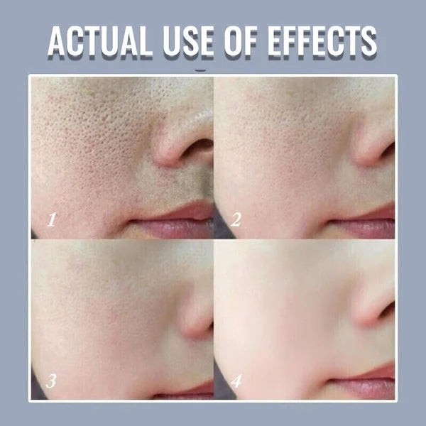 100%Natural&amp;2024 Pore Invisible Cream 🔥 HOT SALE 🔥