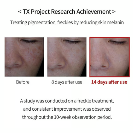 TX Cream -for Dark Spots &amp; Hyperpigmentation