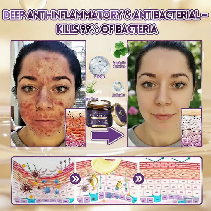 Made and Shipped from USA ✨Gethairlab® Biotin 10-in-1 Skin Restoration Cream 🍀