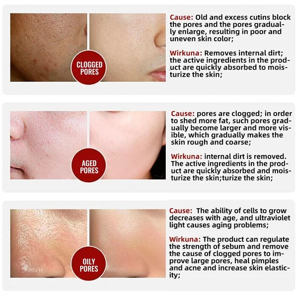 100%Natural&amp;2024 Pore Invisible Cream 🔥 HOT SALE 🔥