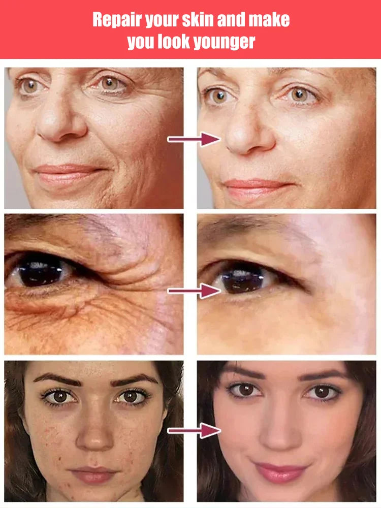 Recombinant Collagen Anti-Wrinkle Serum