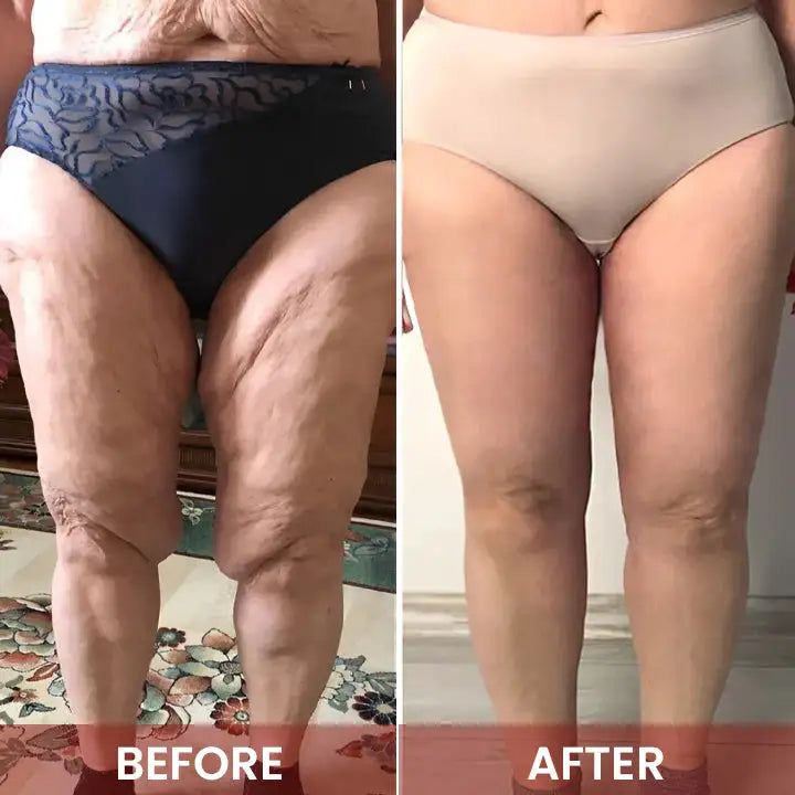 🏆Limited time offer⚡ 50K+ SOLD! Almost Gone-💥Age-Defying Revival Collagen &amp; Stem Cell Body Oil