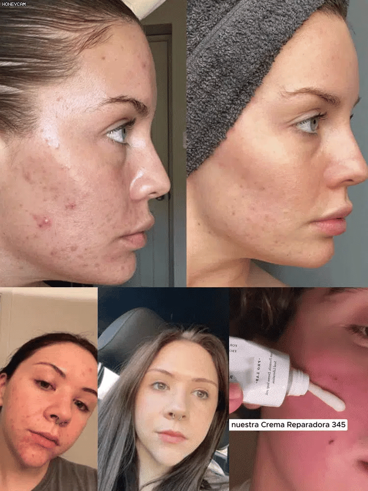 🏆Flash Sale⚡Hydrating and Nourishing Face Cream