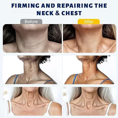 Roller Massage Neck Cream 🧴 Collagen &amp; Hyaluronic Acid | Firms Neck, Reduces Wrinkles &amp; Double Chin
