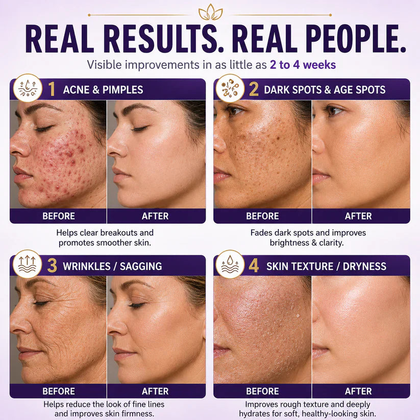 Limited-time offer: 70% off ⬇️Elivessa™ Biotin 10-in-1 Skin Restoration Cream