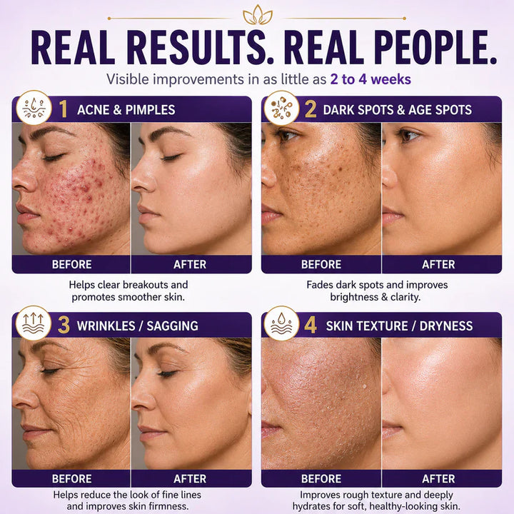 Limited-time offer: 70% off ⬇️Elivessa™ Biotin 10-in-1 Skin Restoration Cream