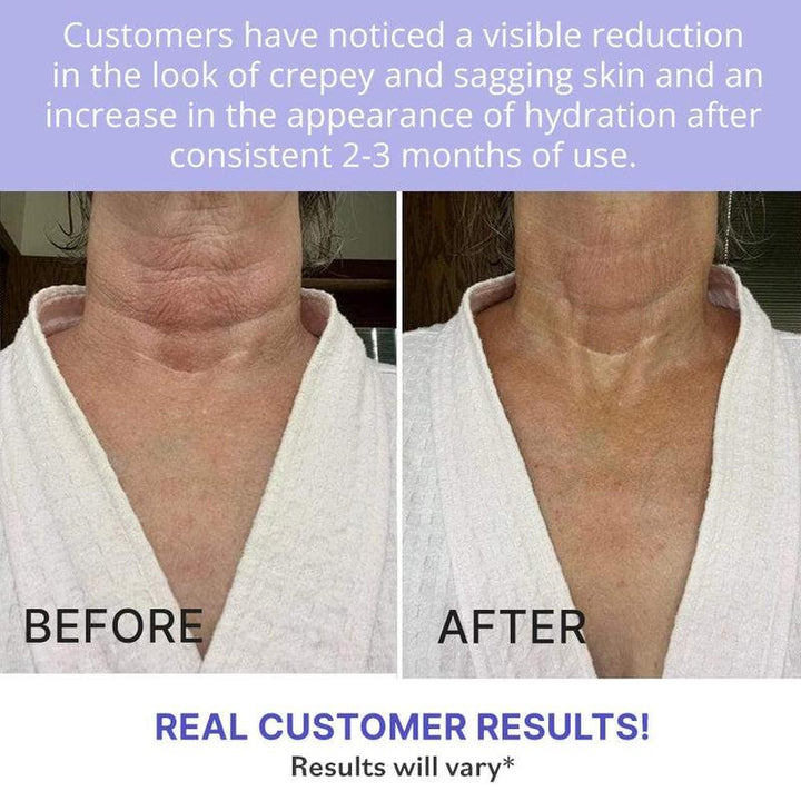 Tighten &amp; Lift FirmingNeck Cream