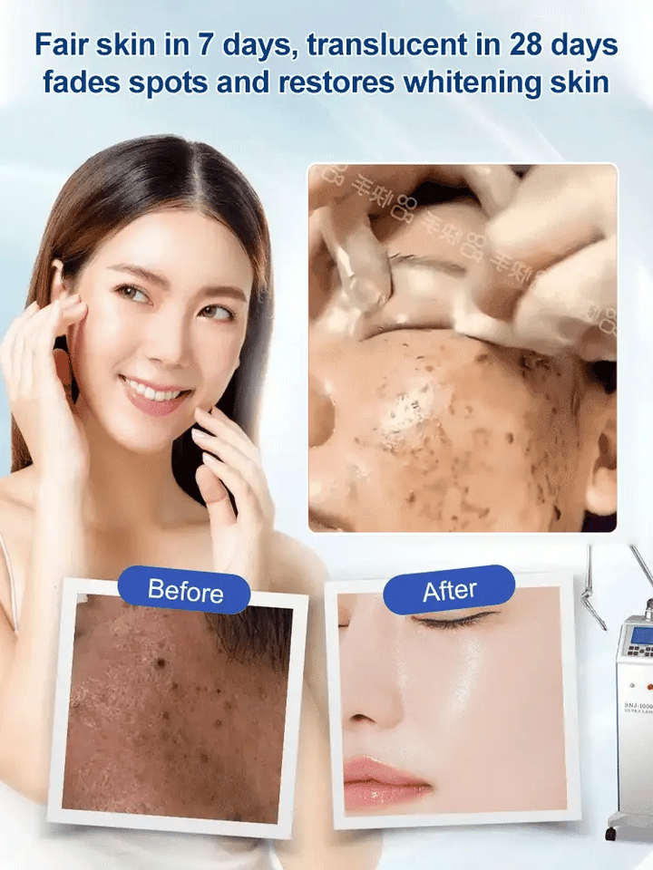 🔥Buy 1 Get 1 Free🔥 Spot Fading Urea Cream
