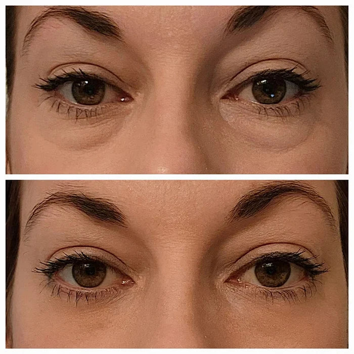 🔥Last Day 49% OFF🎁Instant Eye Temporary Eye Tightener