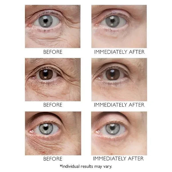 🔥Last Day 49% OFF🎁Instant Eye Temporary Eye Tightener
