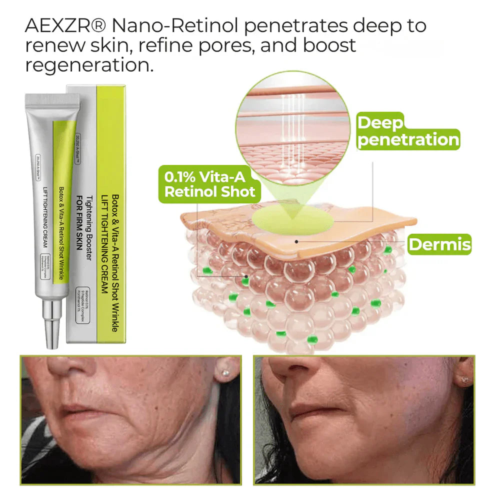 👏🌿Made and shipped from the USA 💫Tiworld® Botox &amp; Vita-A Retinol Shot Wrinkle-Lift Tightening cream - Last Day Promotion 70% OFF