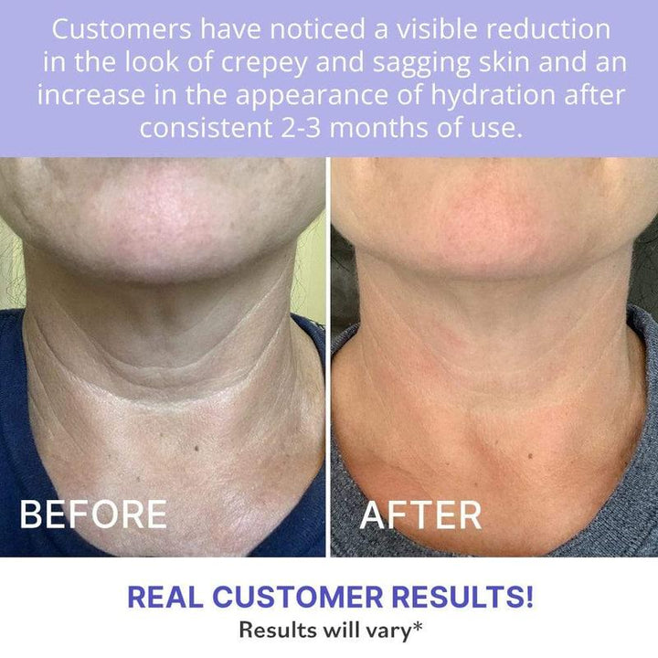 Tighten &amp; Lift FirmingNeck Cream
