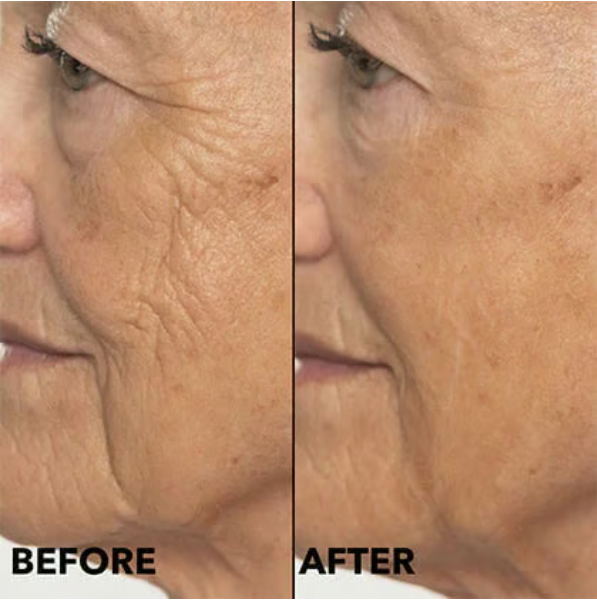 🌟Intense Hydration &amp; Skin Barrier Strength Panthenol Moisturizing Cream