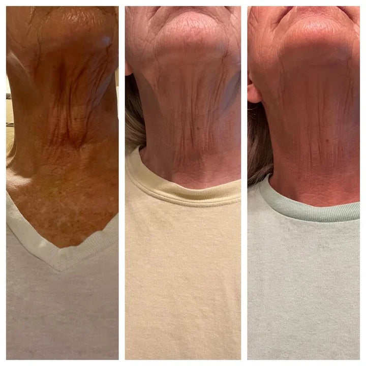 Tighten &amp; Lift FirmingNeck Cream