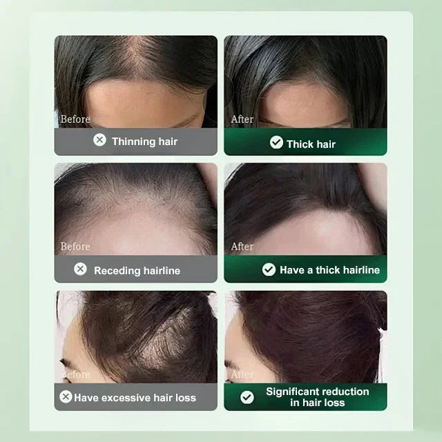 🏆Limited time offer⚡ Ant-Hair Loss And Hair Growth Solution