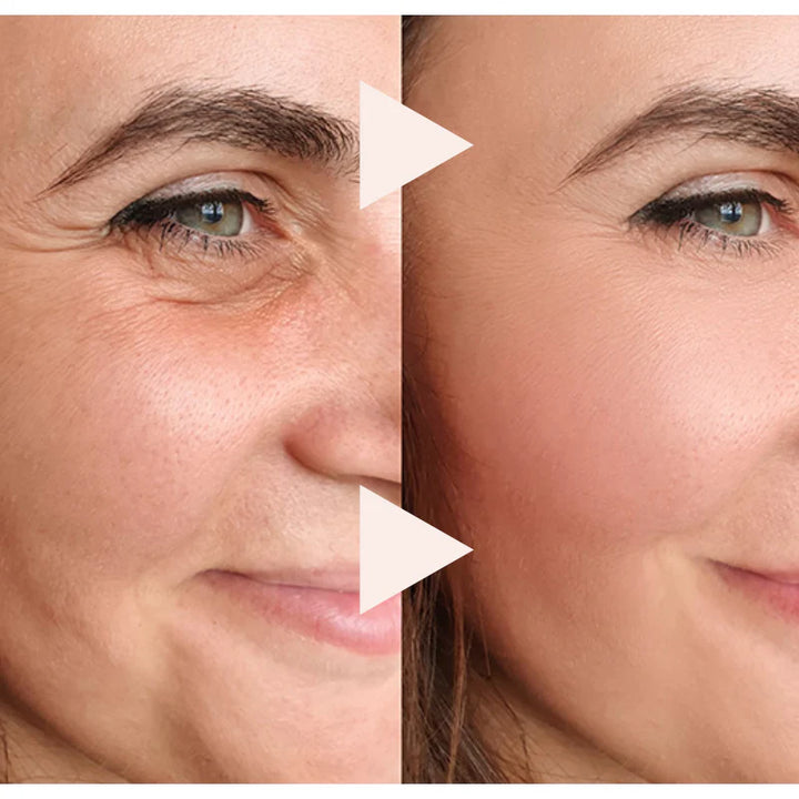🎁BUY 1 GET 1 FREE🔥 The Express Anti-Wrinkle – Instant Lifting Effect