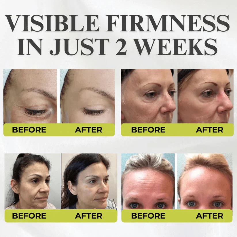 👏🌿Made and shipped from the USA 💫Tiworld® Botox &amp; Vita-A Retinol Shot Wrinkle-Lift Tightening cream - Last Day Promotion 70% OFF
