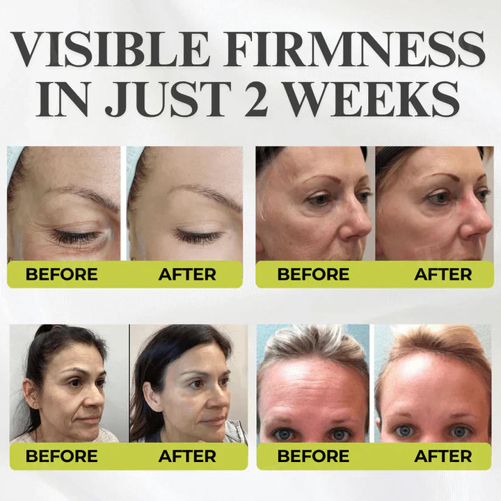 👏🌿Made and shipped from the USA 💫Tiworld® Botox &amp; Vita-A Retinol Shot Wrinkle-Lift Tightening cream - Last Day Promotion 70% OFF