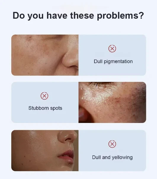 Deep Whitening &amp; Spot Correcting Cream