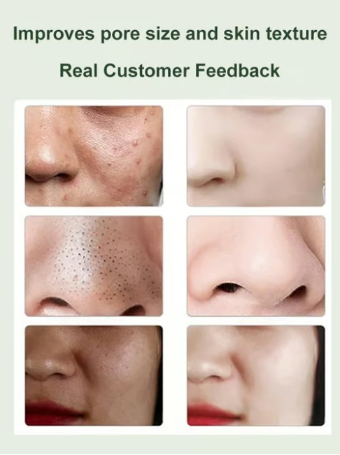 Pore-shrinking Blackhead removal&amp;Oil-control green tomato cleanser