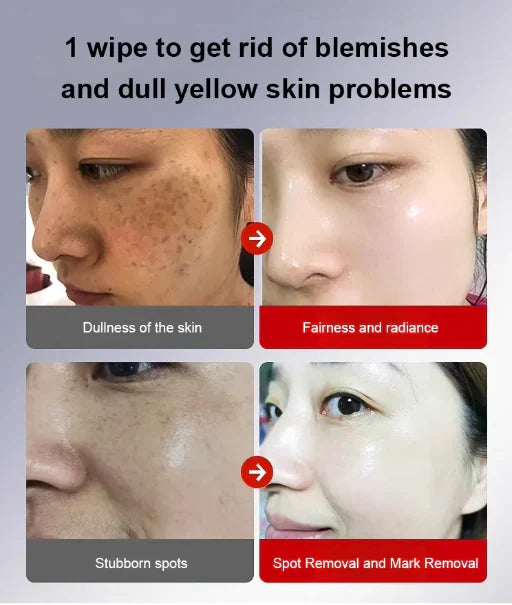 Deep Whitening &amp; Spot Correcting Cream