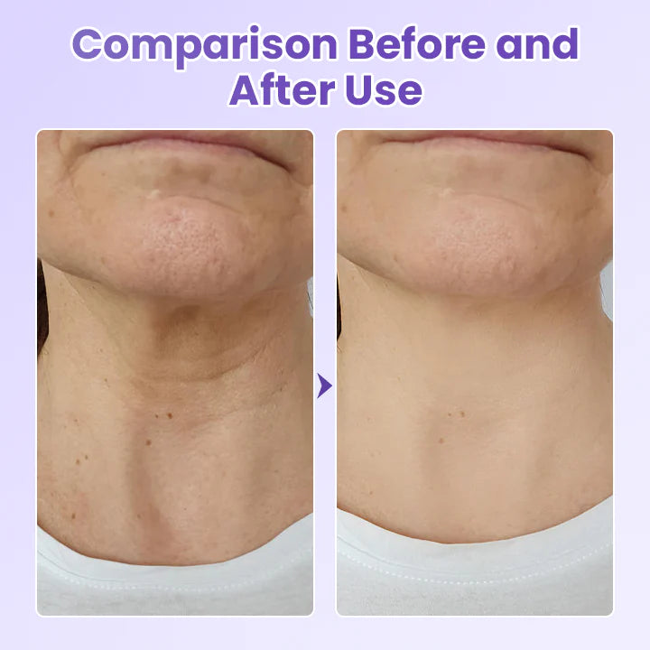 NeckYouth Peptide Anti-Wrinkle Patch