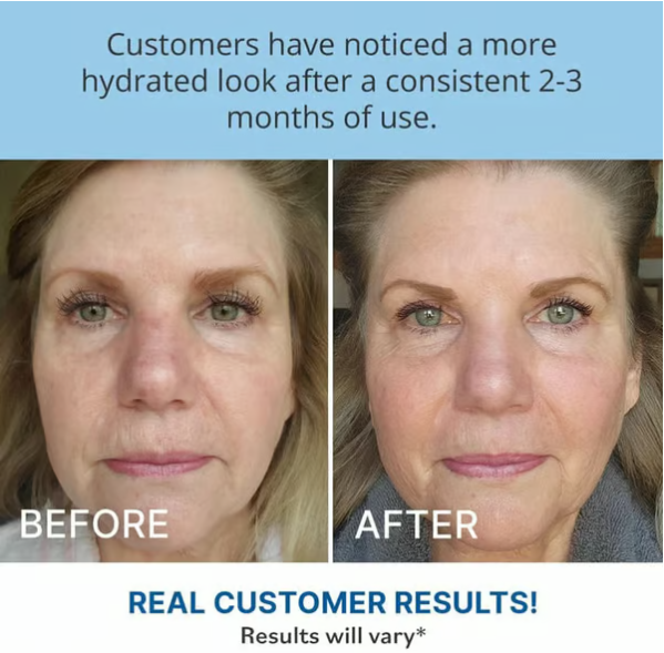 🌟Intense Hydration &amp; Skin Barrier Strength Panthenol Moisturizing Cream